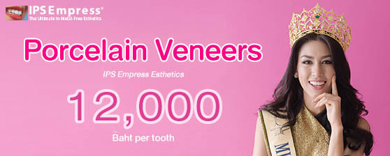 Thailand Dental Veneers