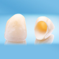 Dental crowns