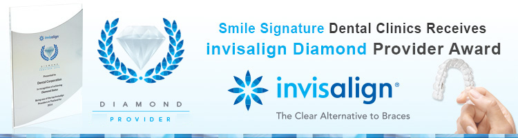 invisalign diamond