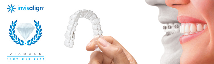 Invisalign