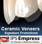 Ceramic Veneers