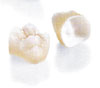 Bangkok Dental Crowns, Thailand Porcelain Crowns