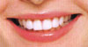 Thailand Tooth Whitening