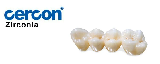 Cercon Zirconia Crowns