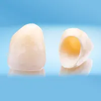 Dental Crowns