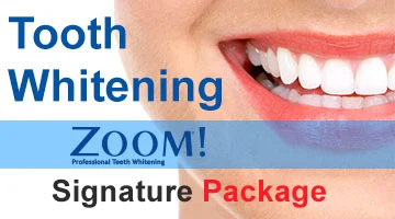 Tooth Whitening