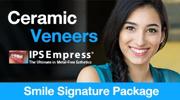 ceramic veneers