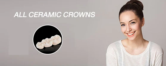 Dental Crowns