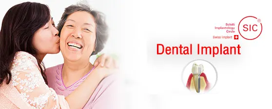 Dental Implant