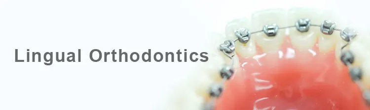 Lingual Orthodontics