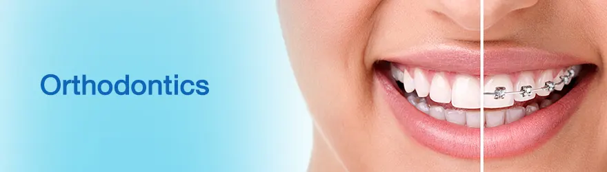 fee Orthodontics dent